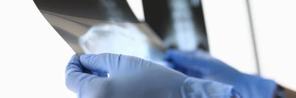 Dokter in handschoenen houdt röntgenfoto 's aan licht close-up. — Stockfoto