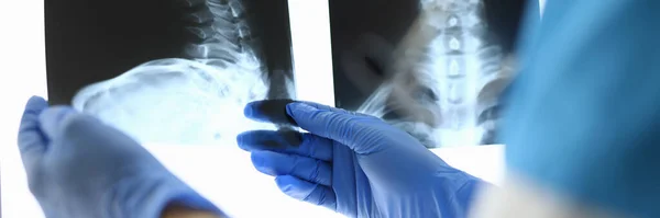 As mãos de doutores em luvas mantêm raios X de ossos — Fotografia de Stock
