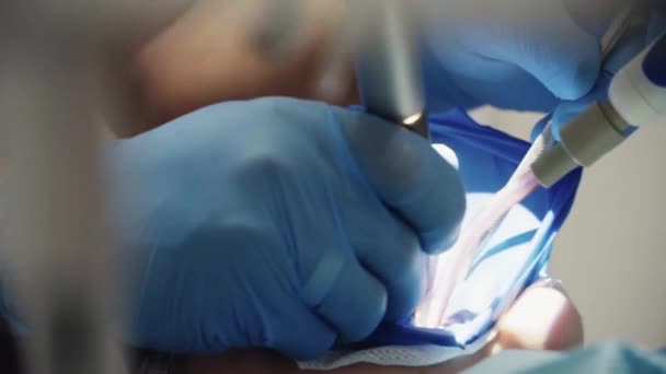 Dental Met Assistent Behandel Patiënt Een Tandartspraktijk Close — Stockvideo