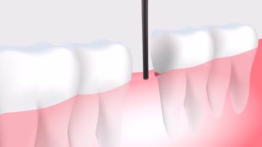 İnsan dişleri Görüntüleri . Kırmızı arka planda yalıtılmış.