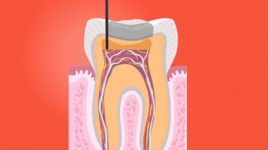 İnsan dişlerinin görüntüleri. Kırmızı arka planda yalıtılmış.