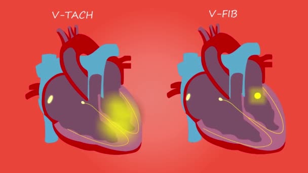 Kalp Görüntüleri Kırmızı Arka Planda Yalıtılmış — Stok video