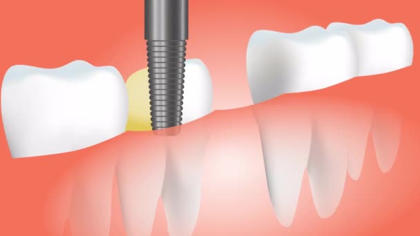 Aufnahmen Menschlicher Zähne Isoliert Auf Rotem Hintergrund — Stockvideo