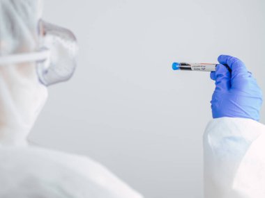 COVID-19. Covid19 veya Coronavirus gibi bulaşıcı hastalıklar. EPP korumalı bir laboratuvar bilim adamı hastane laboratuvarında kan tüpü testleri yapıyor. Coronavirus kan testi.