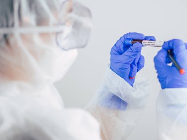 COVID-19. Covid19 veya Coronavirus gibi bulaşıcı hastalıklar. EPP korumalı bir laboratuvar bilim adamı hastane laboratuvarında kan tüpü testleri yapıyor. Coronavirus kan testi.