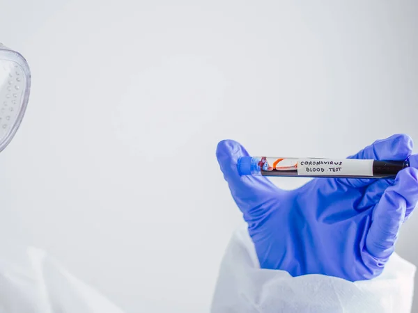 COVID-19. Communicable disease Covid19 or coronavirus. A EPP-protected laboratory scientist performing blood tube tests in the hospital laboratory. Coronavirus blood test.