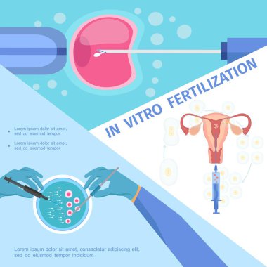 Daire in Vitro Fertilizasyon tıbbi kavramı içinde