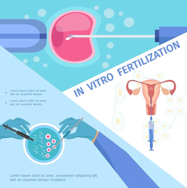 Plano In Vitro Fertilização Conceito Médico —  Vetores de Stock