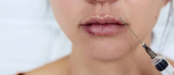 Plastic lips. Women\'s lips after injections of hyaluronic acid. Complications after lip augmentation, close-up scars and bruises.