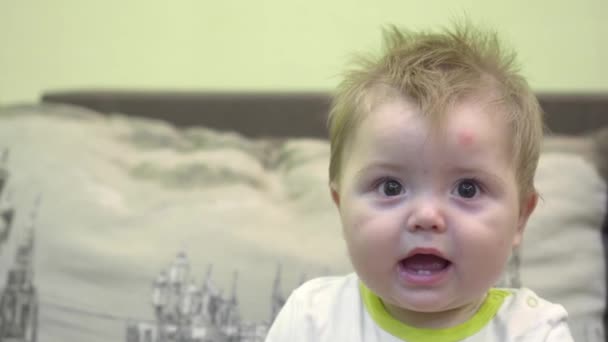 Bebê Sorridente Alegre Com Olhos Grandes Mordida Mosquito Testa Primeiros — Vídeo de Stock