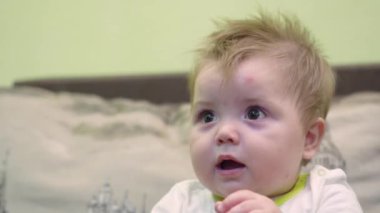 Büyük gözlü, sürpriz bir bebek. Alnından sivrisinek ısırığı. Gözleri vurgulamak için sığ alan derinliği.