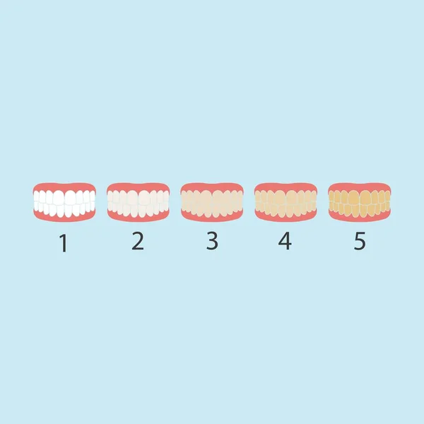 牙齿颜色水平矢量图解设计 — 图库矢量图片
