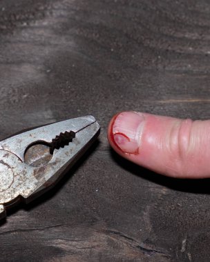 İş yerinde yaralanma, elinde kanla büyük bir baş parmak, bir adam penseyle parmağını yaraladı ve burnunu kanayarak kırdı..