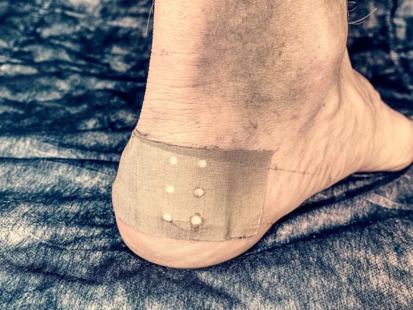 The band-aid on the blister on hurt leg. Sportsman's heel with blister plaster, painful place