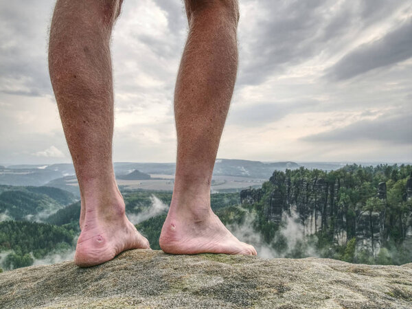 Naked male legs on peak. Sandstone rock with tired hikers legs without shoes. Misty morning climbing.  Outdoor activities.