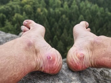 Adam uzun yürüyüşe çıkan kimse çıkar Dağı buzlu terli boots yürüyüş için güzel hava. Yürüyüşçüler topuklar üzerinde zor pathwa detayını. Doğa ve spor tadını çıkarırken faaliyetleri.
