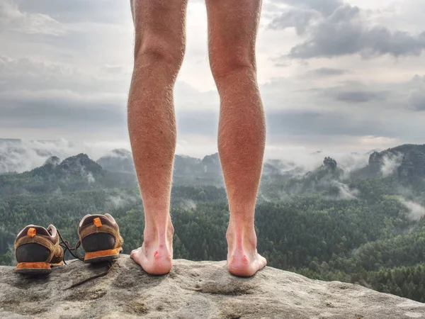 Big Bloody Callus Man Heel Sandstone Rock Tired Hikers Legs — Stock Photo, Image