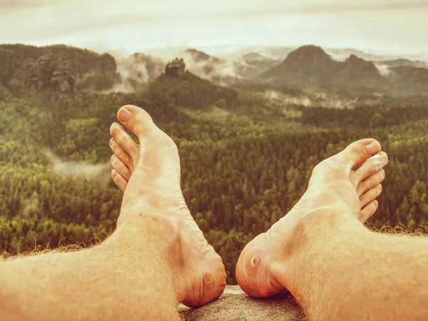 Athlete Trail Runner Take Rest Mountains Legs Bloody Blisters Rocky — Stock Photo, Image