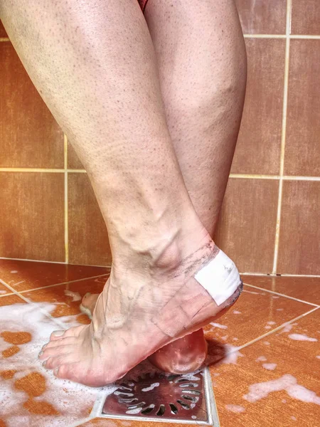 淋浴时脚后跟裂开了贴在妇女脚上的防水贴片 — 图库照片