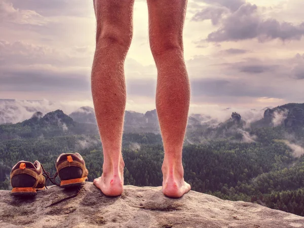 Injured Rock Climber Heel Stand Stone Naked Male Legs Horrible — Stock Photo, Image