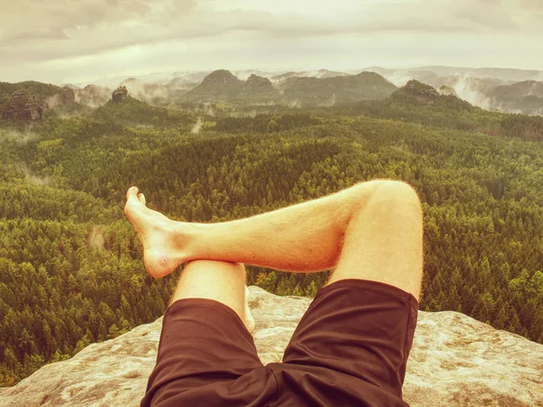 Athlete Trail Runner Take Rest Mountains Legs Bloody Blisters Rocky — Stock Photo, Image