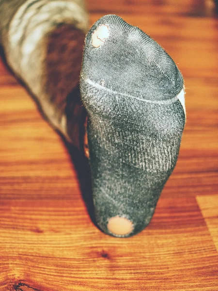 Kid Wearing Dirty Sweaty Socks Holes Heel Pink Skin Soks — Stock Photo, Image