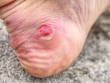 Yürüyüşçüden vurulan birinci şahıs bakış açısı uçurumun kenarında oturmuş 