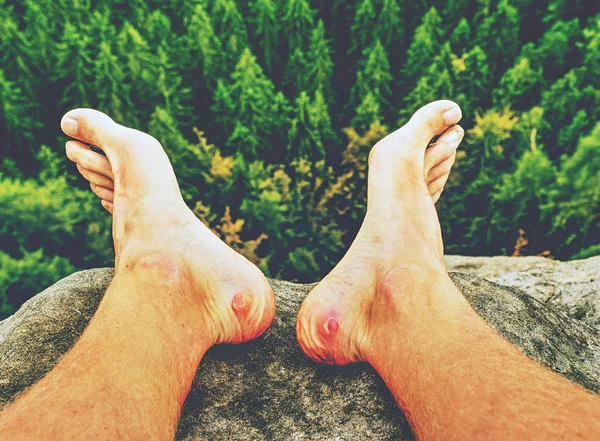 Couple hurt and tired legs resting on the top of the mountain