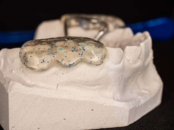 Sádrovcový Model Čelisti Ortodontickým Odnímatelným Držákem Expandéru Ústní Zubařský Nástroj — Stock fotografie