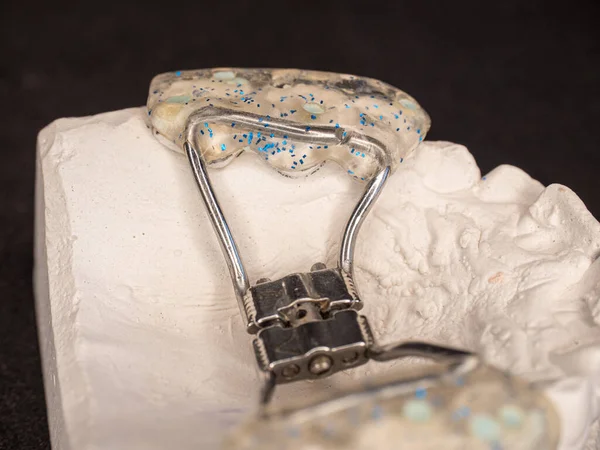 Dental Upper Jaw Bracket Braces Model Dentist Table Reparation Jaw — Stock Photo, Image