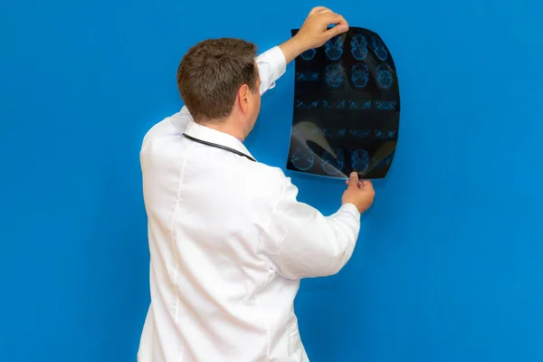 Médico Neurológico Caucásico Reflexivo Mirando Escáner Cerebral Sobre Fondo Azul — Foto de Stock