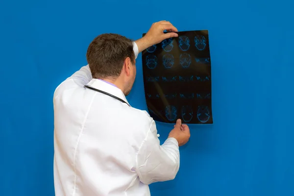 Médico Neurológico Caucásico Reflexivo Mirando Escáner Cerebral Sobre Fondo Azul — Foto de Stock