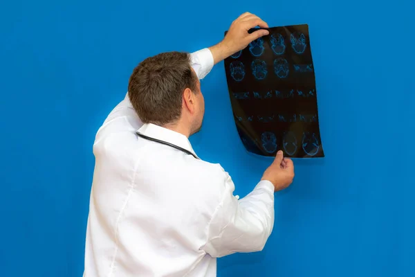 Médico Neurológico Caucásico Reflexivo Mirando Escáner Cerebral Sobre Fondo Azul — Foto de Stock