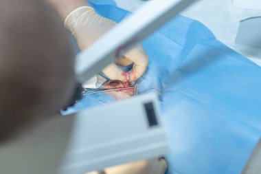 Close up of a testicle during castration of a dog by a veterinary surgeon with focus on testicle. Veterinarian spermatic cord blood vessels fingers