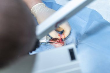 Köpeğin kısırlaştırılmasını genel anestezi ve veteriner cerrahları altında cerrahi masalara koyun. Veteriner köpek kısırlaştırma ameliyatı yapıyor. Klinikte ameliyat yapan veteriner ya da doktor..