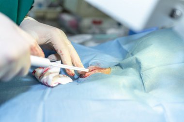 Veteriner cerrahlarını elektrokoagülatörle kapatın ve bir veteriner kliniğinin ameliyathanesinde köpek için ameliyat yapın. Gaziler klinikte ameliyat yapıyor. İlaç, hayvan, hayvan, sağlık hizmetleri konsepti.