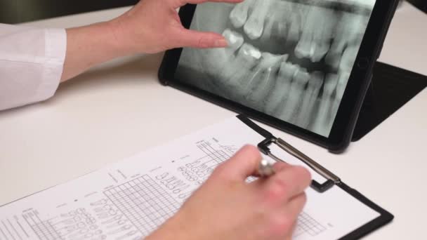 La dentista femenina observa la radiografía de los dientes en una tableta y llena el formulario de verificación. De cerca. — Vídeo de stock
