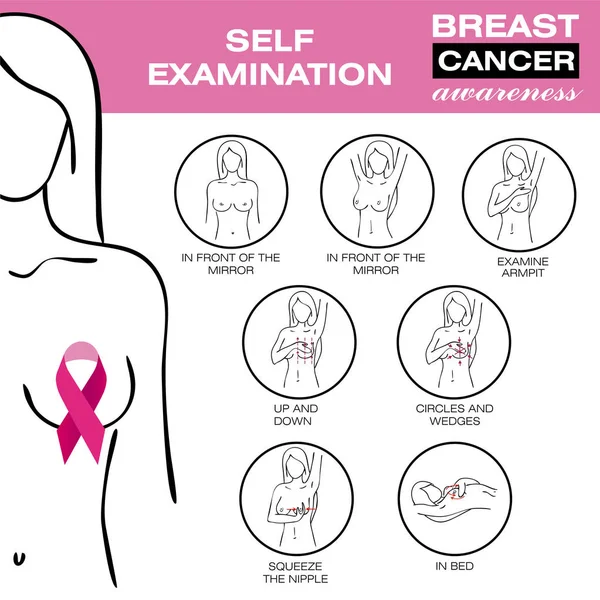 Cancro da mama, infográfico médico. Auto-exame. Conjunto de saúde das mulheres. Consciência do cancro da mama. Cartaz de saúde ou modelo de banner. Diagnóstico. Medicina, anatomia. Ilustração vetorial. —  Vetores de Stock