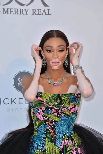 Winnie Harlow — Fotografia de Stock