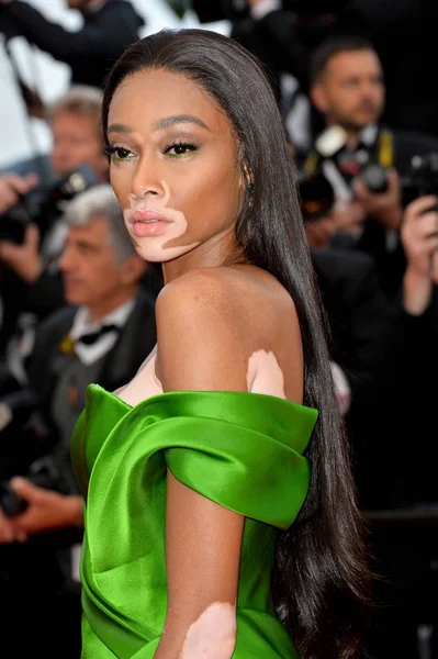 Winnie Harlow — Foto de Stock