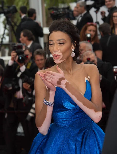 Winnie Harlow — Foto de Stock