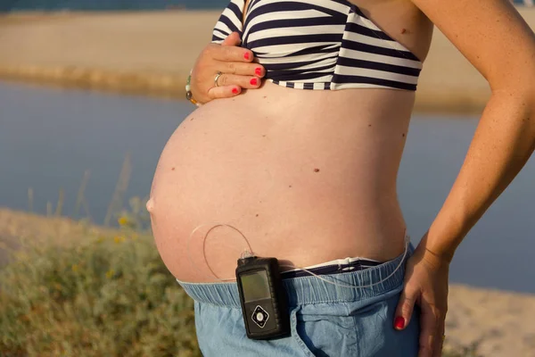 Uma mulher grávida diabética com uma bomba de insulina na praia. Ela... — Fotografia de Stock