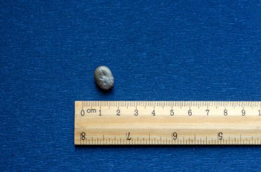 Ixodidae. Mavi arka planda gri ixodid kenesi. Kan dolu bir kene ve boyut netliği için santimetre ölçekli tahta bir cetvel. İnsanlarda beyin iltihabı ve Lyme hastalığı. Hayvanlarda piroplazmoz enfeksiyonu