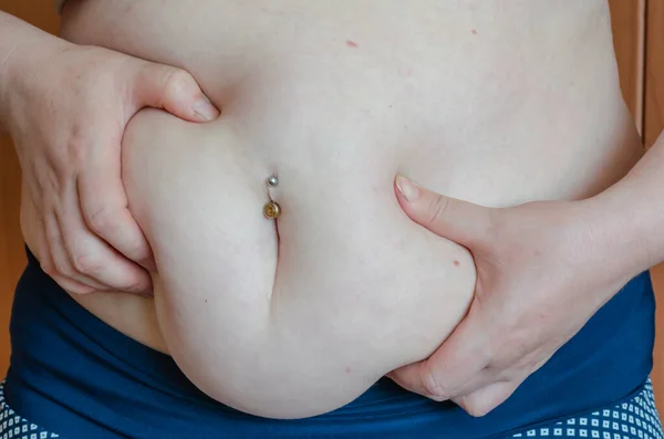 大人の女性は彼女の胃の脂肪の折り目を示す へそピアスの女 太りすぎだ フィギュアの修正 フィットネス — ストック写真