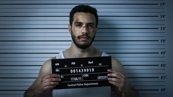 Close-up Shot of an Arrested Beaten Man in a Police Station Poses for Front View Mugshot. He Wears Singlet, is Heavily Bruised and Holds Placard. Height Chart in the Background. — Stock Photo, Image