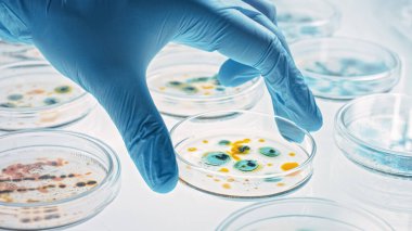 Bilim adamı çeşitli bakteri, doku ve kan örnekleriyle Petri Tabakları ile çalışıyor. Antibiyotikler için farmasötik araştırma kavramı, DNA ile hastalıkları iyileştirme ilaçları. Yakın çekim Makro taşınıyor