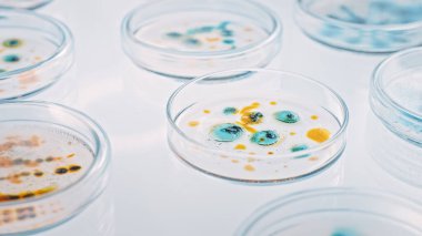 Mikrobiyoloji Laboratuvarı: Çeşitli Bakteri örnekleriyle Petri Tabakları, Pipette Damlaları Sıvı Çözümü. Antibiyotiklerin farmasötik araştırması, Salgınlarla Mücadele Hastalıkları. Makro 'yu yakın plan
