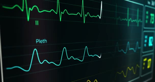 Ekg Hjärtfrekvens Cardio Monitor Sjukhus Ekg Elektrokardiogram Andning Och Spo2 — Stockvideo