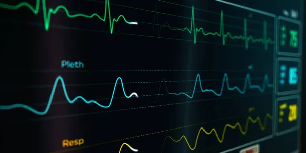 Hastanedeki EKG kalp atış hızı monitörü. EKG elektrokardiyogram, solunum ve SPO2 oksijen doygunluğu tıbbi muayenesi. Hasta kalp monitörü. Kalp atışı görüntüleme çizimi.