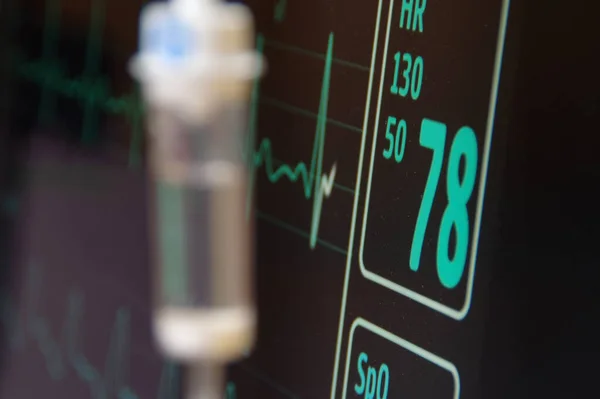 Damla ve kalp atış hızı EKG kardiyo monitörü. Hastanede tedavi görüyor. Kalp atışı görüntüsü. EKG elektrokardiyogram, solunum ve ilaç yönetimi. Hasta kalp monitörü..